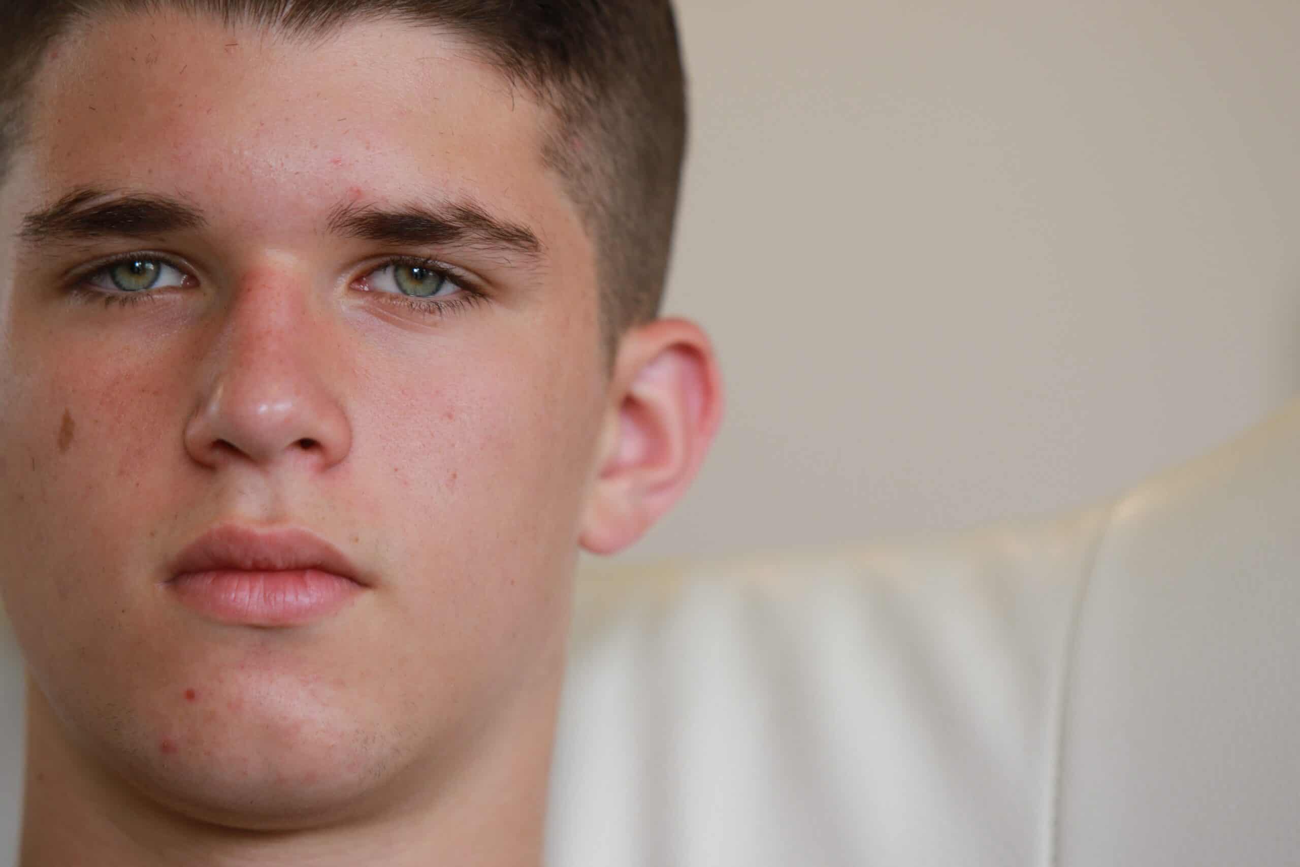 jóvem que precisa de terapia para adolescente